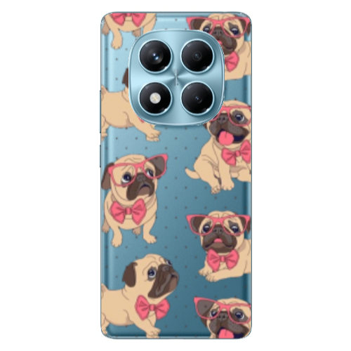 Xiaomi Redmi Note 14 Pro Dog Spectacled Transparent Silicone TPU Θήκη