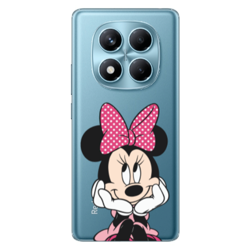 Xiaomi Redmi Note 14 Pro Minnie 2 Transparent Silicone TPU Θήκη
