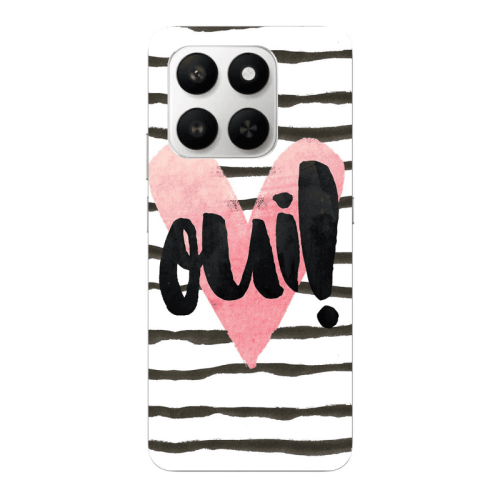 Honor Magic 400 Smart Girl boss qoui Transparent Silicone TPU Θήκη