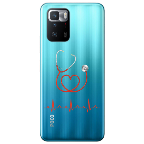 Xiaomi Poco X3 GT Stethoscope Transparent Silicone TPU Θήκη