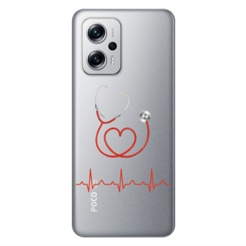 Xiaomi Poco X4 GT Stethoscope Transparent Silicone TPU Θήκη