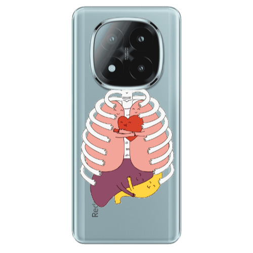 Xiaomi Redmi Note 14 Pro + 5g Anatomy Transparent Silicone TPU Θήκη