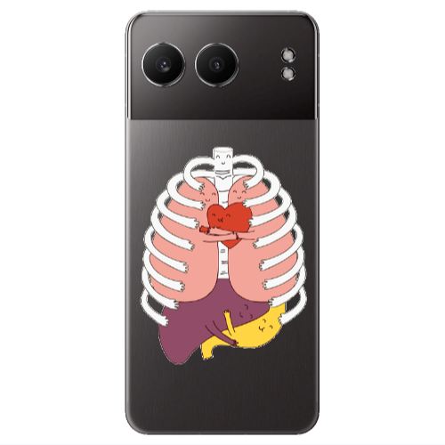 Oneplus Nord 4 Anatomy Transparent Silicone TPU Θήκη