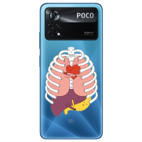 Xiaomi Poco X4 Pro Anatomy Transparent Silicone TPU Θήκη