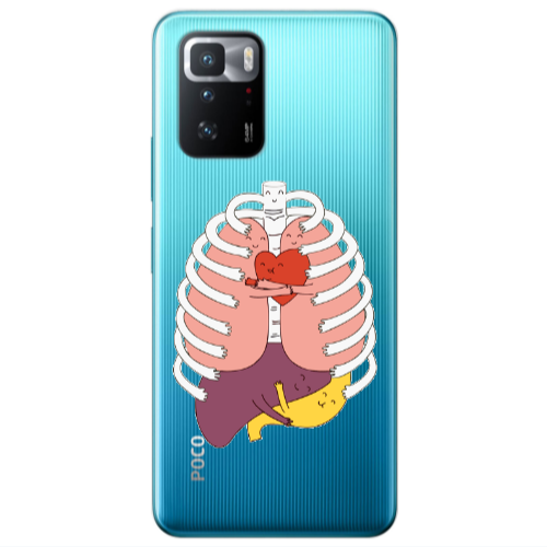 Xiaomi Poco X3 GT Anatomy Transparent Silicone TPU Θήκη