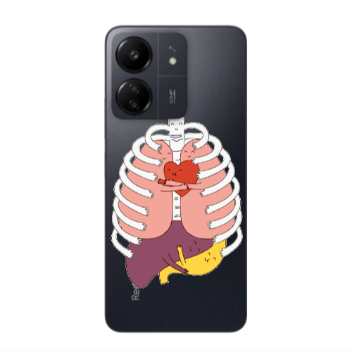 Xiaomi Redmi 13C Anatomy Transparent Silicone TPU Θήκη