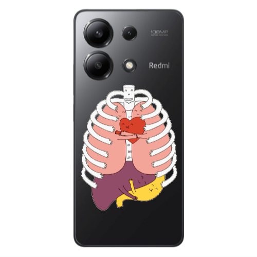 Xiaomi Redmi Note 13 4G Anatomy Transparent Silicone TPU Θήκη