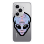 Honor Magic 400 Pro Alien Transparent Silicone TPU Θήκη