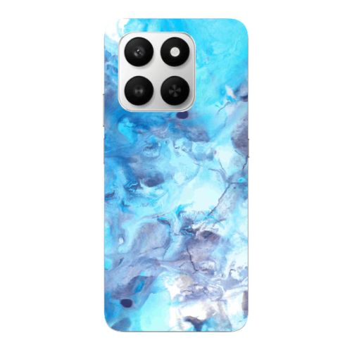 Honor Magic 400 Smart Marble Clouds Transparent Silicone TPU Θήκη