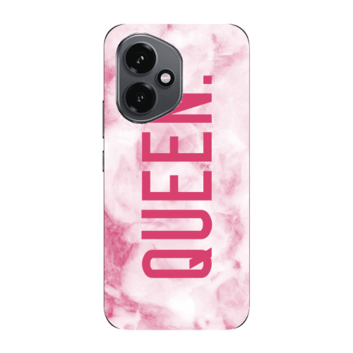 Honor Magic 400 Marble Queen Transparent Silicone TPU Θήκη