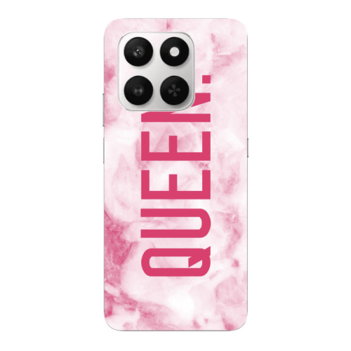 Honor Magic 400 Smart Marble Queen Transparent Silicone TPU Θήκη