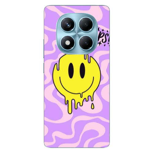 Xiaomi Redmi Note 14 Pro Oops Transparent Silicone TPU Θήκη