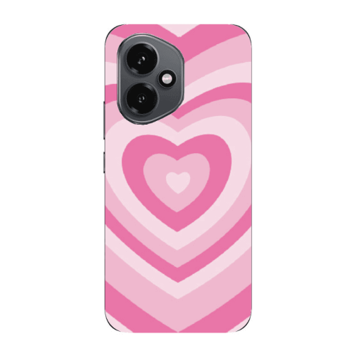 Honor Magic 400 Hypnotizing Transparent Silicone TPU Θήκη