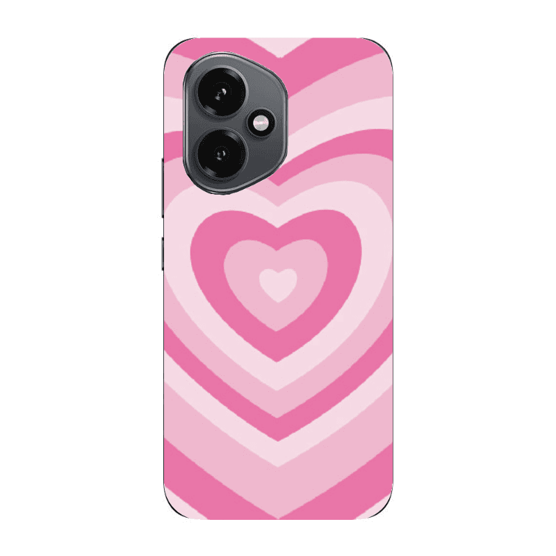 Honor Magic 400 Hypnotizing Transparent Silicone TPU Θήκη