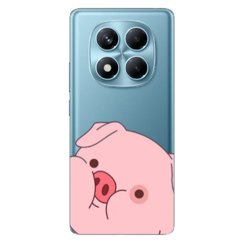 Xiaomi Redmi Note 14 Pro Piggy 2 Transparent Silicone TPU Θήκη